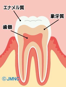 冷たいものが歯にしみる時 疑うべき3つの原因 福岡市博多区 東区 歯周病なら松本歯科医院